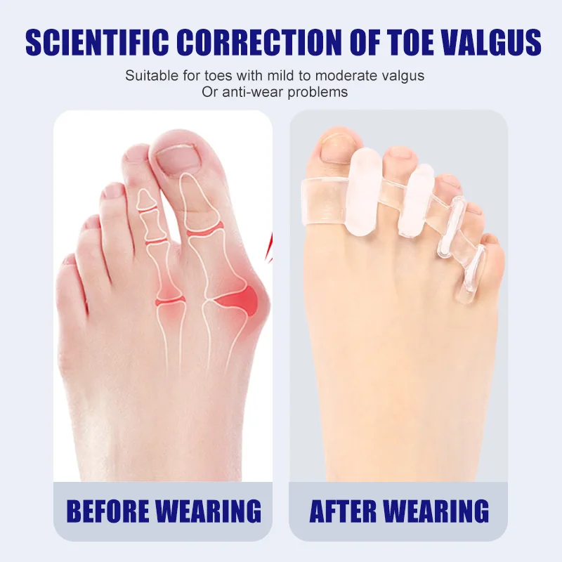 1 Pair Silicone Toe Separator  - Toe Separator Silicon review and price
