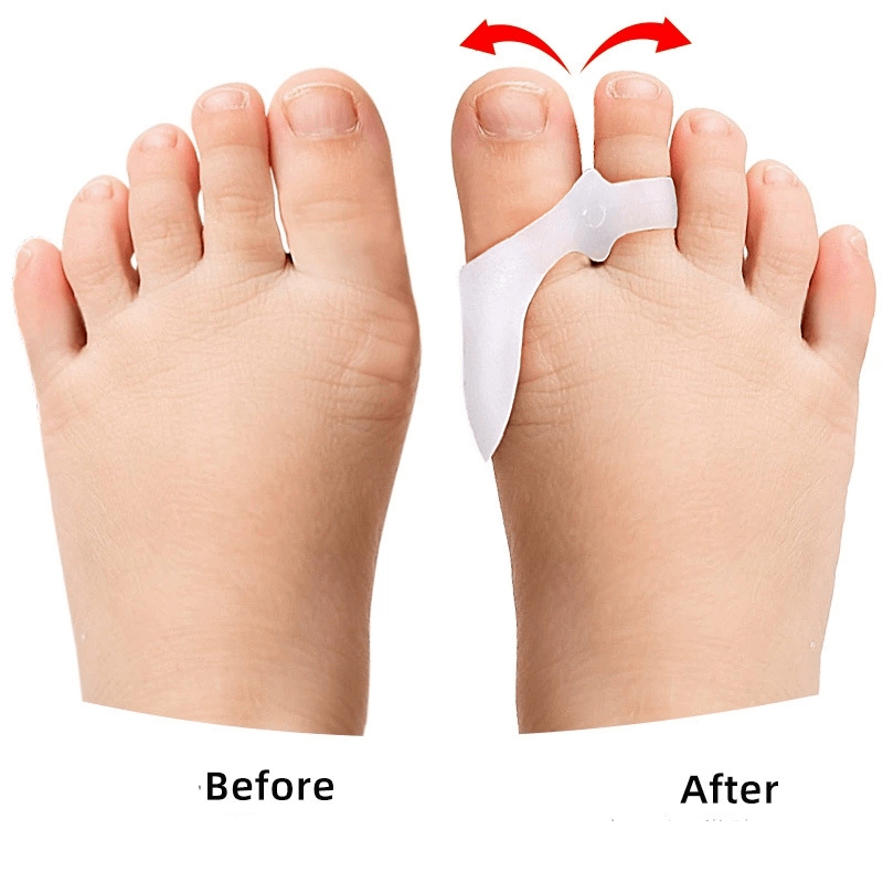 1/2/3Pairs Children's Gel Toe  - Toe Separator Silicon review and price