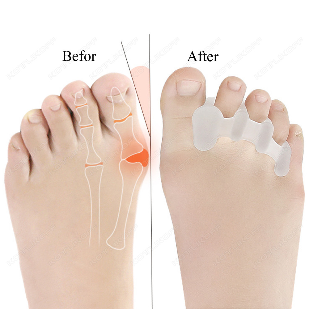 Toe Protective Toes Separator  - Toe Separator Silicon review and price