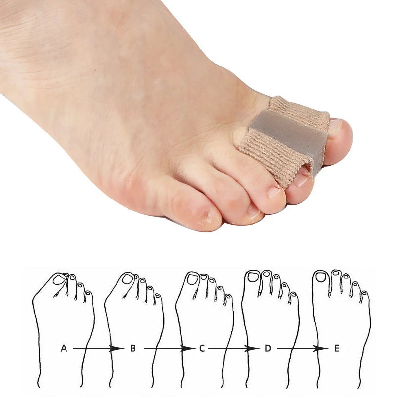 New Toe Separator Hallux Valgu - Toe Separator Silicon review and price